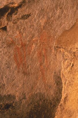 RARI LEE RSA MRI1 81